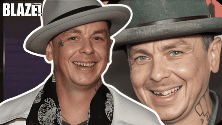 Sid Wilson Teeth | What they are, why they matter, and what fans should know